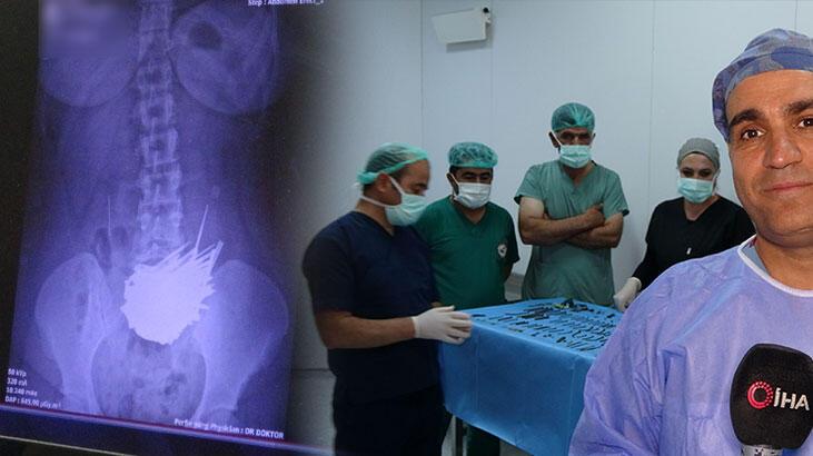 Midesinden çıkanlar dehşete düşürdü! Doktorlar bile inanamadı