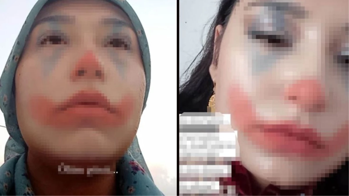 Niğde'de zorla evlendirilmek istenen kız çocuğunun ailesi ve damat adayı gözaltına alındı