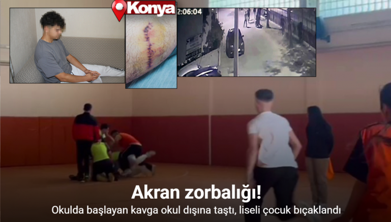 Okulda başlayan kavga okul dışına taştı, liseli çocuk bıçaklandı
