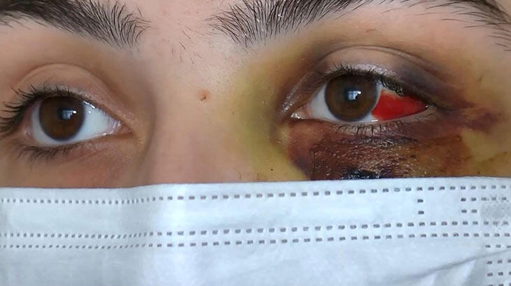 'Ölmeyi mi bekleyeyim?'