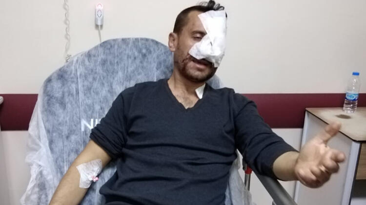 Otomobile kaya parçası düşen muhtar: Birden camı kırarak içeri girdi