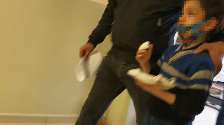 Parkta feci olay! 8 yaşındaki çocuğun parmağı koptu