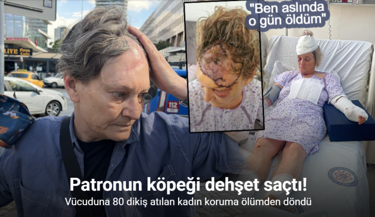 Patronun köpeği dehşet saçtı: Vücuduna 80 dikiş atılan kadın koruma ölümden döndü