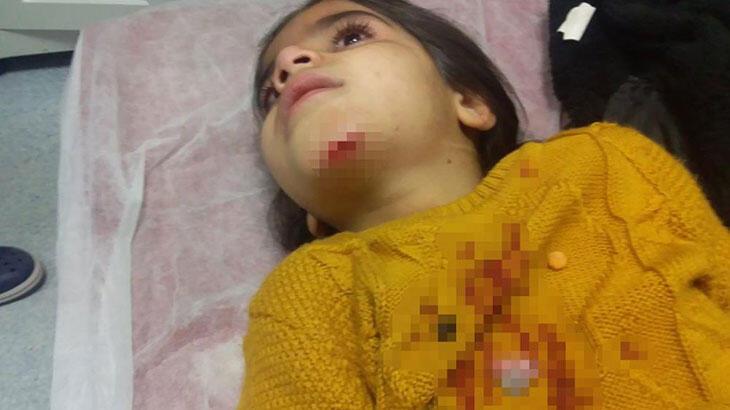 Rögar kapağı açık bırakıldı, 7 yaşındaki çocuk çukura düştü