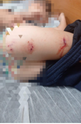 Sokak köpekleri faciaya neden oluyordu: Komşular yetişmeseydi parçalayacaklardı