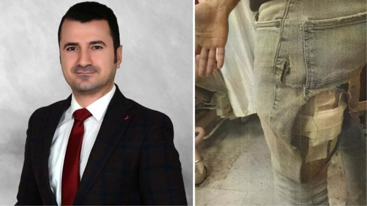 Sokak köpeklerinin yaraladığı avukat, İzmir Büyükşehir Belediyesi'ne açtığı tazminat davasını kazandı