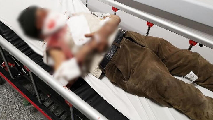 Son dakika... Misafirliğe gittiği evde dehşeti yaşadı!  Önce yüzünü, sonra vücudunu parçaladı