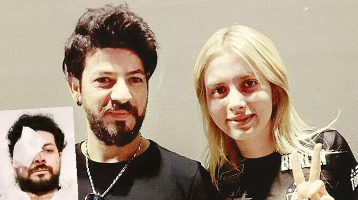 Son Dakika: Genç şarkıcı Şahan Dinç'e büyük şok! Gözünü kaybetti