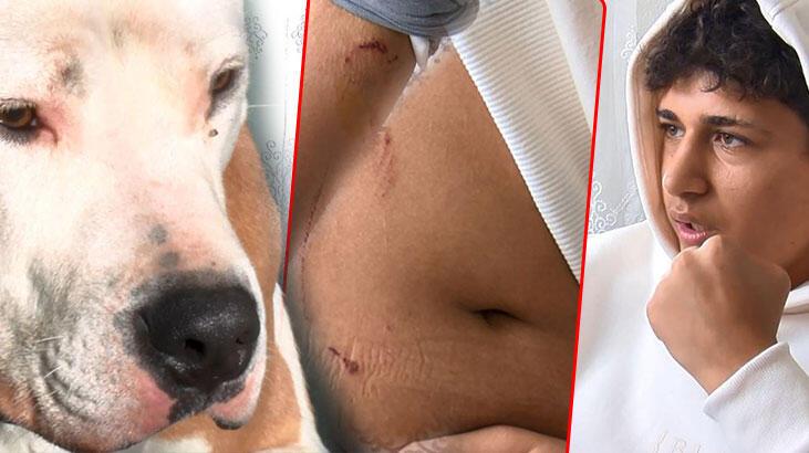 Sultangazi'de Pitbull dehşeti! Sahibi 'tut' deyince saldırdı