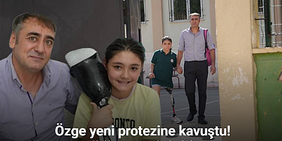 12 yaşındaki Özge yeni protezine kavuştu, okul heyecanı yeniden başladı