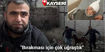 3 yaşındaki çocuğuna köpek saldıran baba: 