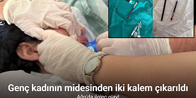Ağrı’da genç kadının midesinden endoskopiyle iki kalem çıkarıldı
