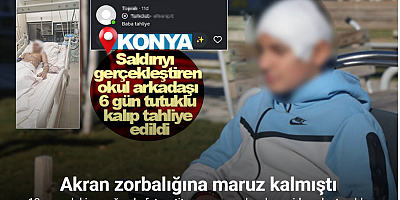 Akran zorbalığına maruz kalan 13 yaşındaki çocuğun kafatası titanyum parçalarıyla yeniden oluşturuldu