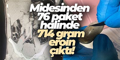 Batman'da bir kişinin midesinden 714 gram eroin ele geçirildi