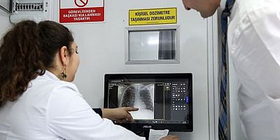 Bir skandal da verem teşhisinde