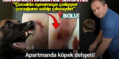 Bolu’da Belçika kurdu çocuğu kalçasından ısırdı, sahibinin sözleri pes dedirtti