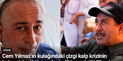 Cem Yılmaz’ın kulağındaki çizgi kalp krizinin habercisi mi? Uzmanların dikkat çektiği “Frank işareti”