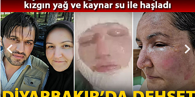 Çocuklarının gözü önünde eşini kızgın yağ ve kaynar su ile haşladı 