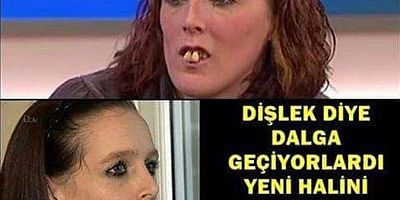 Dişlek diye dalga geçiyorlardı. Yeni halini görünce şok olacaksınız