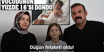 Düğün felaketi oldu: 8 yaşındaki Elif, 7 operasyon geçirdi