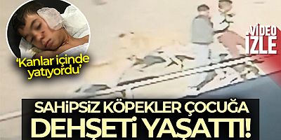 Edirne'de köpekler çocuğa dehşeti yaşattı: O anlar kamerada