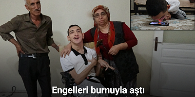Engelleri burnuyla aştı: Telefonuyla hayata tutundu