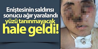 Eniştesinin saldırısı sonucu ağır yaralandı, yüzü tanınmayacak hale geldi