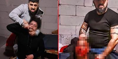 Fırat Kaya'nın acımasızca dövdüğü işitme engelli gencin darp vidosunu çeken kişi açığa alındı