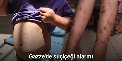Gazze'de suçiçeği alarmı: Vakalar iki haftada 9 bini aştı