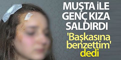 Genç kız, tanımadığı kişi tarafından sokak ortasında 'Muşta' ile darp edildi