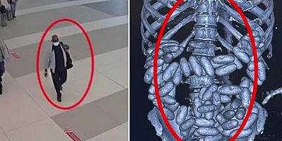 Havalimanında Nijerya uyruklu yolcunun midesinden bin 844 gram kokain ele geçirildi