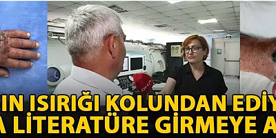 Hırsızın ısırığı kolundan ediyordu; vaka literatüre girmeye aday