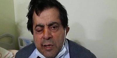 Kafasına çatıdan buz kütlesi düştü, ölümden döndü