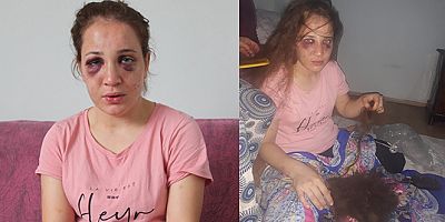 Koçası 3 çocuk annesini bu hale soktu 