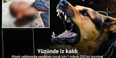 Köpek saldırısında yaralanan çocuk için 1 milyon 200 bin tazminat