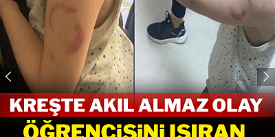 Kreşte akıl almaz olay: Öğrencisini ısıran öğretmen tutuklandı
