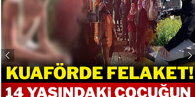 Kuaförde dehşet: 14 yaşındaki çocuğun tüm vücudu yandı!