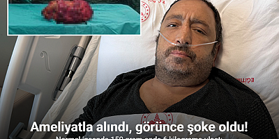 Mardin’de 6 kiloluk böbrek, ameliyatla alındı