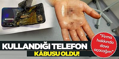 Meslek taşımızın eşinin elinde Telefonu patladı, eli parçalandı