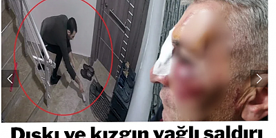 Öğretmen, komşusunun hayatını zindana çevirdi: Kapısına dışkı ve kızgın yağ bırakıp yüzünü yaraladı