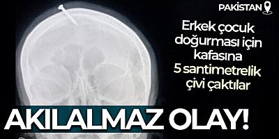 Pakistan'da erkek çocuk doğurmak için hamile kadının kafasına 5 santimetrelik çivi çaktılar