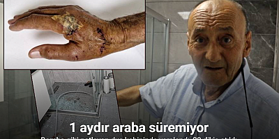 Patlayan duş kabininde yaralandı, 1 aydır direksiyon başına geçemiyor