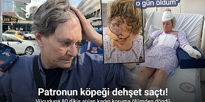 Patronun köpeği dehşet saçtı: Vücuduna 80 dikiş atılan kadın koruma ölümden döndü