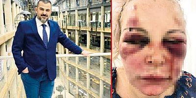 Rus kadın otel odasındaki işkenceyi bu sözlerle anlattı: Ellerindeki kanımı yalayıp 'Tadı ne güzelmiş' diyordu