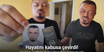 Saçlarını siyahlatmak için aldığı şampuan arı sokmasından beter hale getirdi