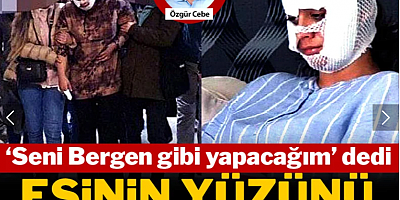 “Seni Bergen gibi yapacağım” dedi, yüzümü paramparça etti!
