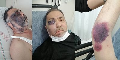 SON DAKİKA Yüzde 90 engelli adamı öldüresiye darp ettiler