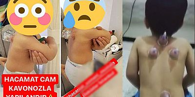 Sosyal medyadaki o görüntülere uzmanlardan uyarı