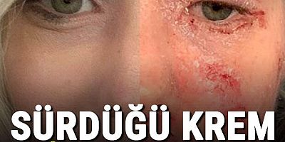 Sürdüğü krem kâbusu oldu! 'Acı dayanılmazdı'