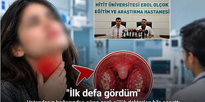 Vatandaşın boğazından çıkan canlı sülük doktorları bile şaşırttı: 